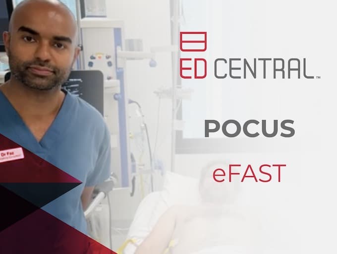 POCUS - eFast